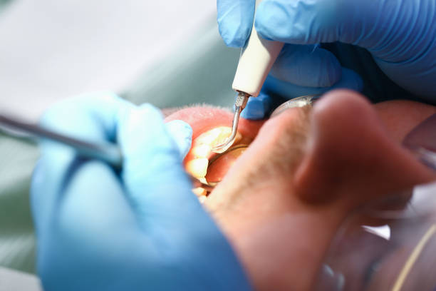 Best Walk-In Emergency Dental Services in Marysville, KS