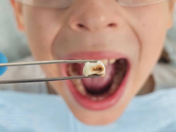 Best Emergency Pediatric Dental Care in Marysville, KS
